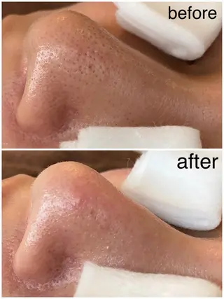 マツエク・マツパ 韓国肌管理 【毛穴専科】のエステ・リラクイメージ