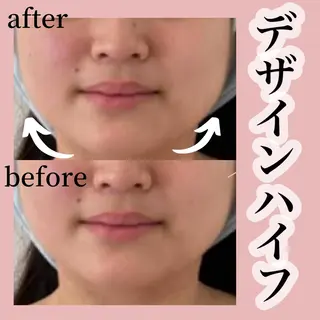 ■超絶小顔&肌管理室■所属・🦋整形級の究極美顔 本格韓国式小顔🦋のエステ・リラクイメージ