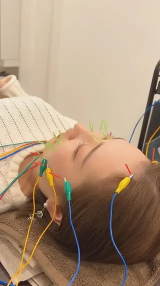 美容鍼灸Solana所属・肌質改善×美容鍼 ゆいのエステ・リラクイメージ