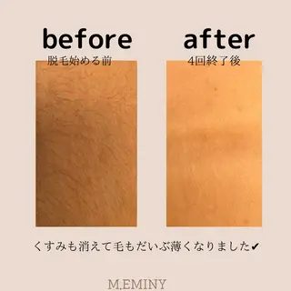 脱毛 &relaxation　M.EMINY所属・大分賀来リラクサロン M.EMINYのエステ・リラクイメージ