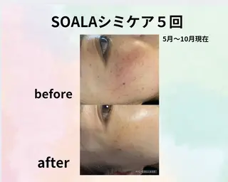 美容整体師  江上のエステ・リラクイメージ