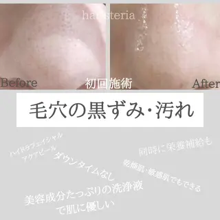 小顔・ツルツル素肌 ハリステリアのエステ・リラクイメージ