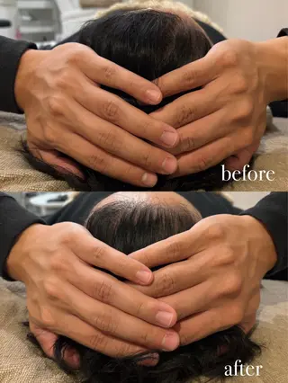 メンズ ENNE🦩小顔整体 師🌿 HINAKOのエステ・リラクイメージ