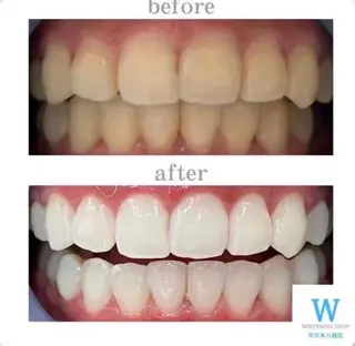 ホワイトニング ショップ本八幡店のエステ・リラクイメージ