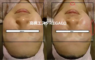 REGALO所属・矢野 さやかのエステ・リラクイメージ