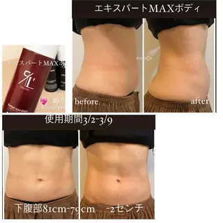 private salon  Dea_maris シュガーリング＆パーソナルボディケア所属・シミ改善・韓国肌管理 ボディメイク痩身のその他イメージ