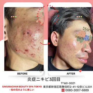 ニキビ、痩身、脱毛、 サクラチャンスパのエステ・リラクイメージ