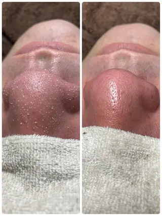 メンズ メンズガーデン今池店所属・メンズガーデン 今池の眉毛・アイブロウイメージ