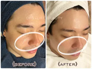 メンズ OPS×LIFE BEAUTY所属・OPS×LIFE BEAUTY/maiのエステ・リラクイメージ
