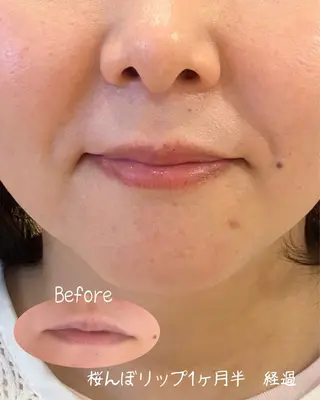 Healthy Heartのエステ・リラクイメージ