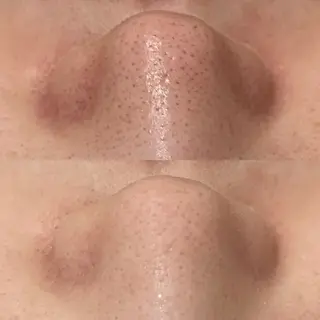 触れたくなる モテ肌へ...❤︎のエステ・リラクイメージ