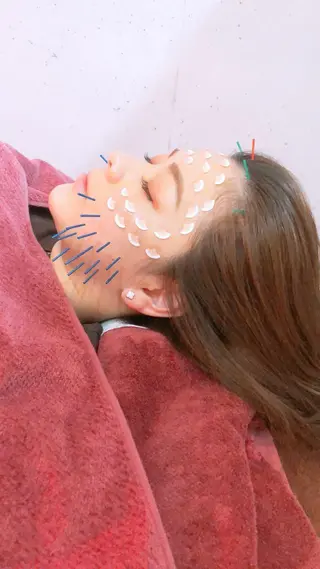 美容鍼灸女性専用 りんご鍼灸治療院のその他イメージ