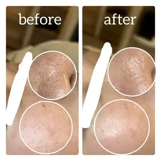 BEAUTY SALON R's所属・BEAUTY SALON R'sのエステ・リラクイメージ