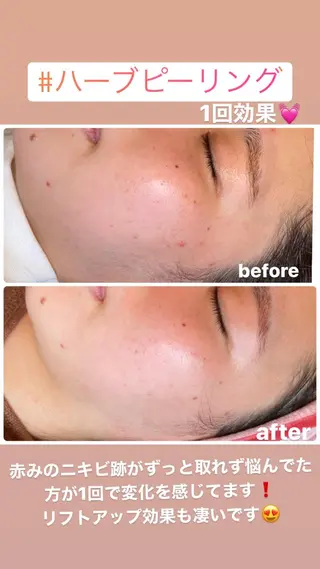 FLEUR大阪・整体 ・ハイフ・痩身・小顔のエステ・リラクイメージ