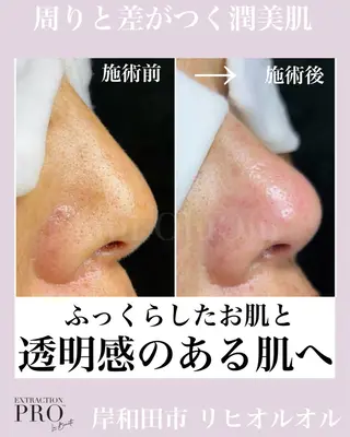 毛穴汚れ改善専門店/ 岸和田/リヒオルオルのエステ・リラクイメージ