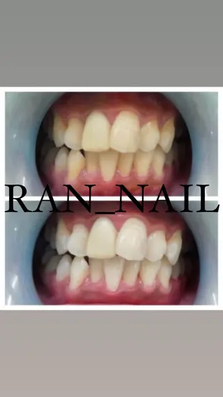 志免町 フェイスシャルエステのエステ・リラクイメージ