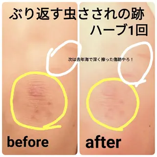 未病ケアサロン EMINY所属・未病ケアサロン EMINY☺︎勝俣のエステ・リラクイメージ