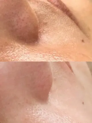 Hit. シュガーリング豊橋のエステ・リラクイメージ