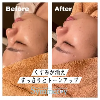 小顔矯正専門店 シンメトリー札幌のエステ・リラクイメージ