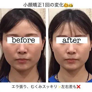 渋谷小顔矯正 毛穴洗浄ウミのエステ・リラクイメージ