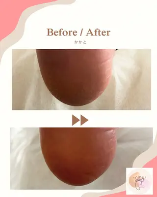 フットケアサロン miraiのその他イメージ