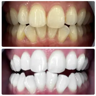 LOVE ホワイトニング戸辺のその他イメージ