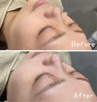 LiZA エステティックサロンのエステ・リラクイメージ