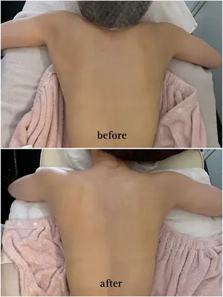 肌質改善 ￤ POLA￤カワナベのエステ・リラクイメージ