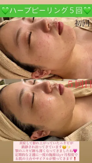 メンズ Salon de Lino 御器所のエステ・リラクイメージ