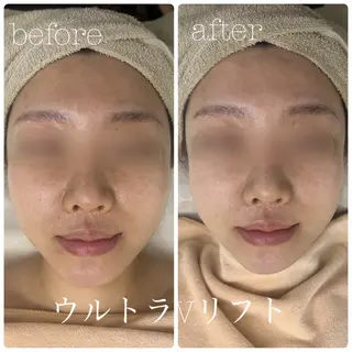 フェイシャルサロン CHIARA 荒田のエステ・リラクイメージ