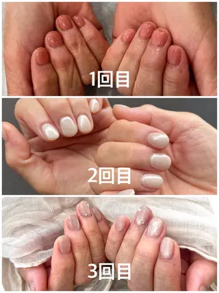 ネイル AIMER所属・AIMER シミケア/エステのその他イメージ