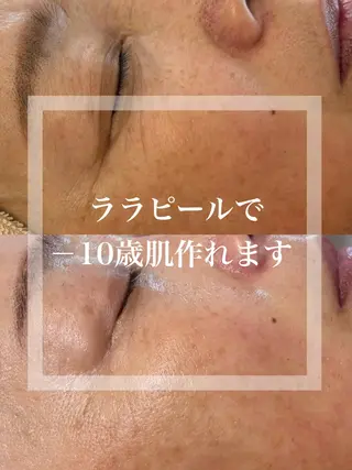 WHITE AQUA 北千住店のエステ・リラクイメージ