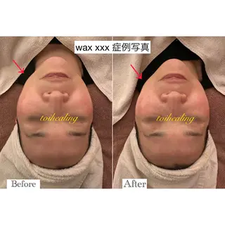 肌質改善サロン　toihealing所属・肌質改善サロン トワヒーリングのエステ・リラクイメージ