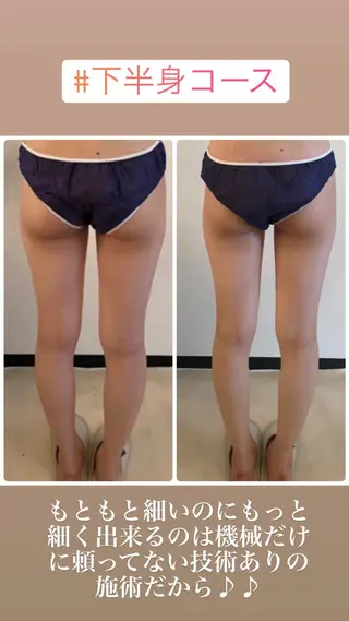 FLEUR大阪・整体 ・ハイフ・痩身・小顔のエステ・リラクイメージ