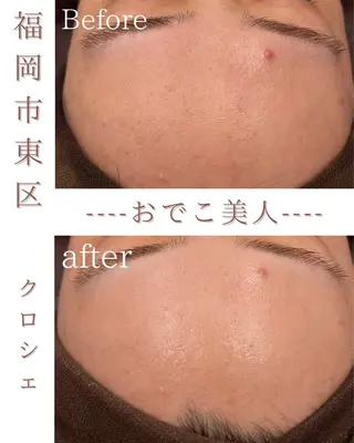 政時 鈴奈のエステ・リラクイメージ