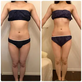 FLEUR大阪・美容 整体・痩身・小顔のエステ・リラクイメージ