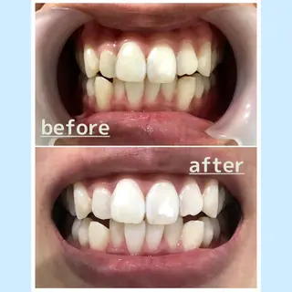 お手軽ホワイトニングsalon mina所属・武元 奈津美のその他イメージ