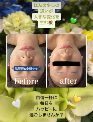 ■超絶小顔＆肌管理室■所属・🦋整形級の究極美顔 本格韓国式小顔🦋のエステ・リラクイメージ