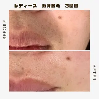 メンズ 古々本 明歩のエステ・リラクイメージ