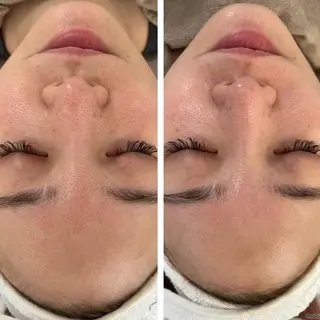 脱毛&Beauty salon IILA所属・垢抜けお手伝い💖 Sakuraの眉毛・アイブロウイメージ