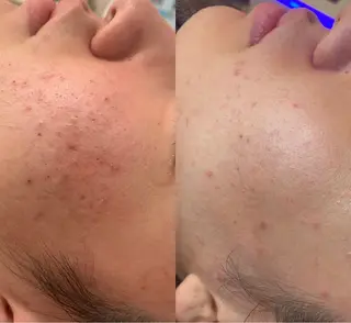 韓国肌管理ララピール クリスタルビューティのエステ・リラクイメージ