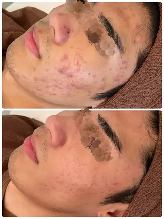 ハーブピーリング専門 BIOPLUS＋川崎のエステ・リラクイメージ