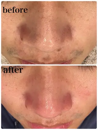 infinity所属・Infinity インフィニティのその他イメージ