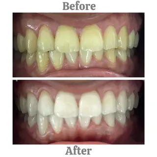 セルフホワイトニング　エクシア相模大野店所属・セルフホワイトニング エクシア相模大野店のその他イメージ