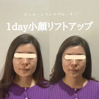 最速小顔・肌質管理 ❣️エスポワールのエステ・リラクイメージ