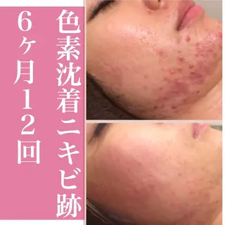 憧れ韓流素肌に🪽 毛穴肌管理のエステ・リラクイメージ