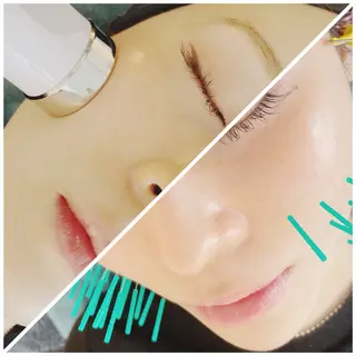 小顔美容鍼専門サロン 渋谷YZのエステ・リラクイメージ