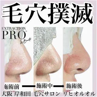 毛穴汚れ改善専門店/ 岸和田/リヒオルオルのエステ・リラクイメージ