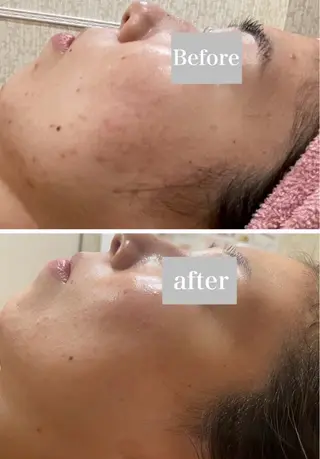 エステ矢野 ジョアアンジェ心斎橋のエステ・リラクイメージ