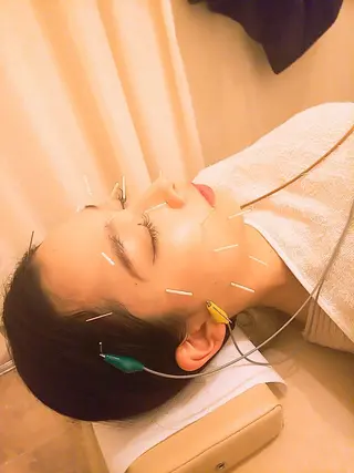 むくみたるみ専門☆ 美容鍼・小顔矯正のエステ・リラクイメージ